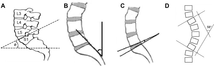 Impact of overweight and obesity on the musculoskeletal system using ...