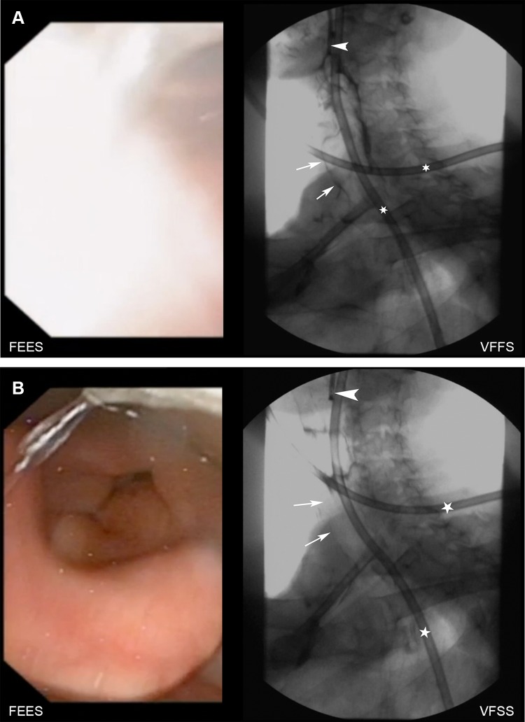 Fig. 2