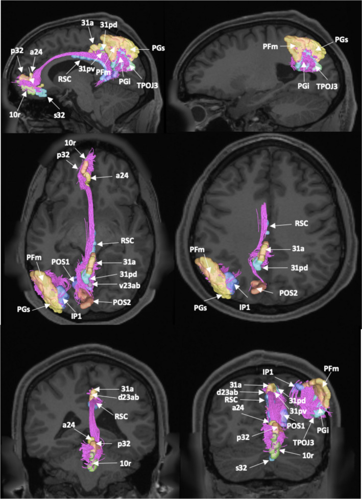 FIGURE 3