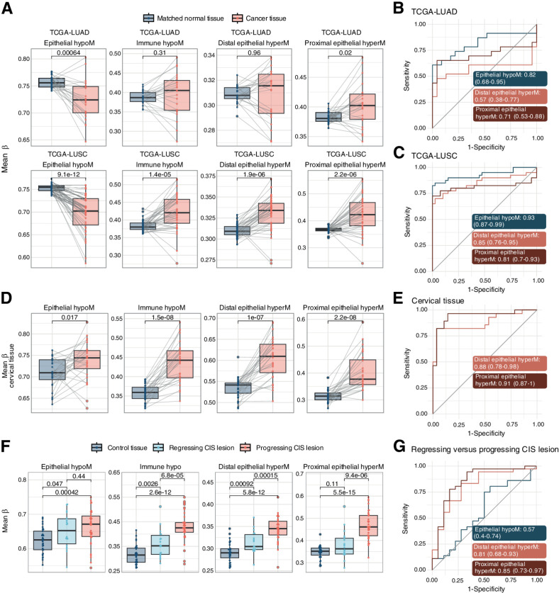 Figure 5. Mean methylation beta of smoking-associated CpG sets in cancer tissue and progressing versus regressing CIS lesions. A, Mean methylation beta values in each set in TCGA LUAD and LUSC projects. Only samples with matched normal control tissue were included to control for smoking exposure. P values are derived from a paired Wilcoxon test. B and C, AUC plots for mean methylation levels in epithelial hypoM, distal epithelial hyperM, and proximal epithelial hyperM, comparing matched control tissue versus lung cancer tissue in TCGA-LUAD (B) and TCGA-LUSC (C). D, Mean methylation beta values in each set in cervical cancer or matched normal tissue (GSE211668). Only samples with matched normal control tissue were included to control for smoking exposure. P values are derived from a paired Wilcoxon test. E, AUC plots for mean methylation levels in epithelial hypoM, distal epithelial hyperM, and proximal epithelial hyperM, comparing matched control tissue versus cervical cancer tissue (GSE211668). F, Mean methylation beta values in the smoking-associated CpG sets in control lung tissue, regressing CIS lesions, or progressing CIS lesions. P values are derived from paired Wilcoxon tests. G, AUC plots for mean methylation levels in epithelial hypoM, distal epithelial hyperM, and proximal epithelial hyperM, comparing matched regressing CIS versus progressing CIS lesions.