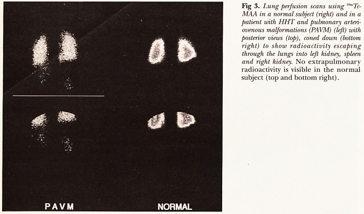 Fig 3.