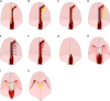 Fig. 2