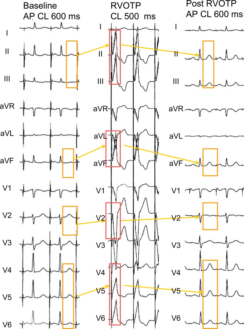 Fig. (6)