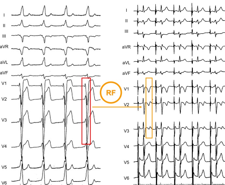 Fig. (5)