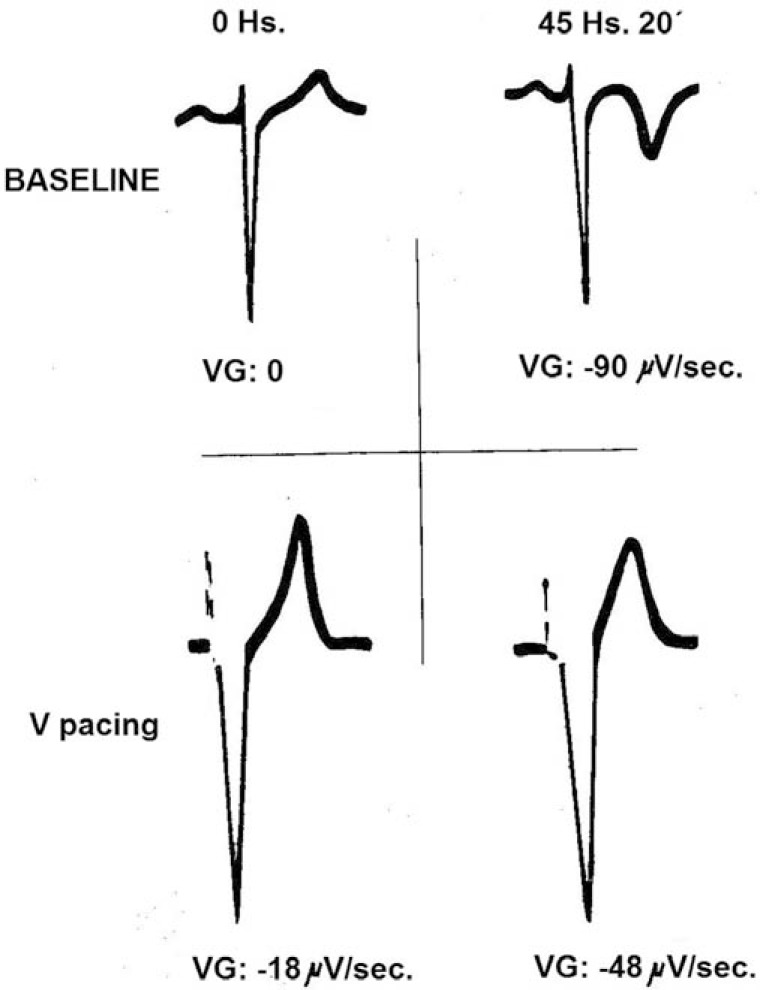 Fig. (11)