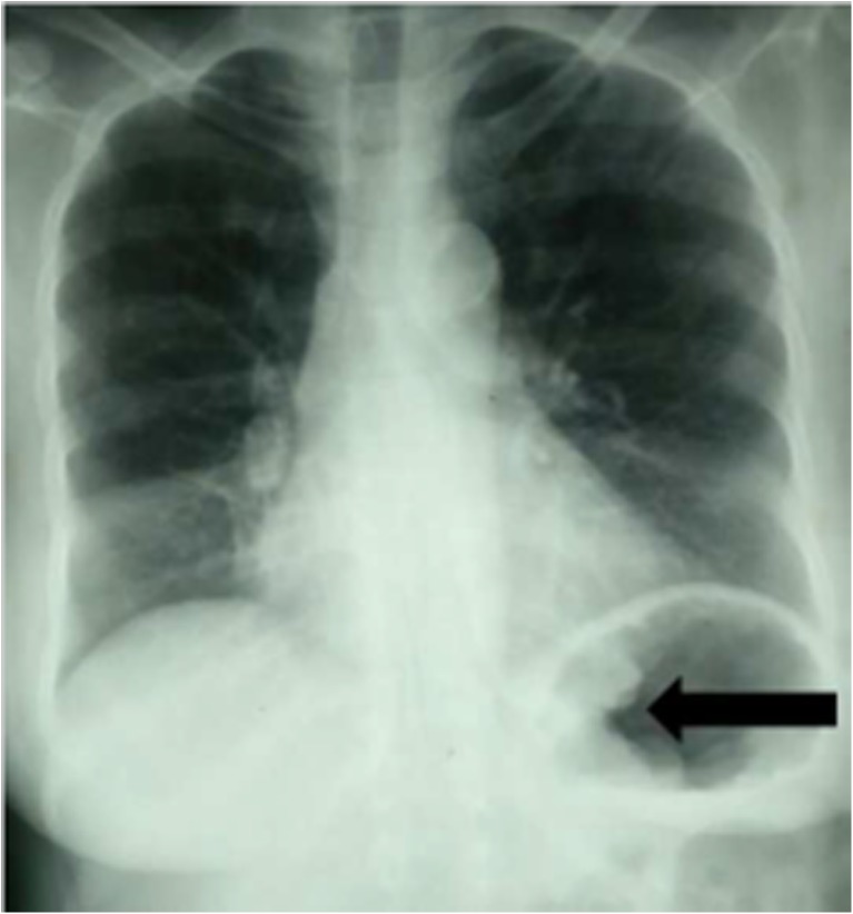 Fig. 1