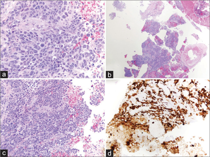 Figure 2: