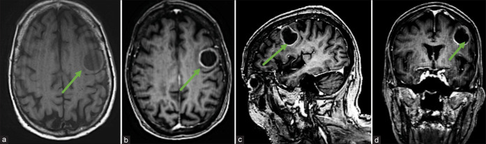 Figure 1: