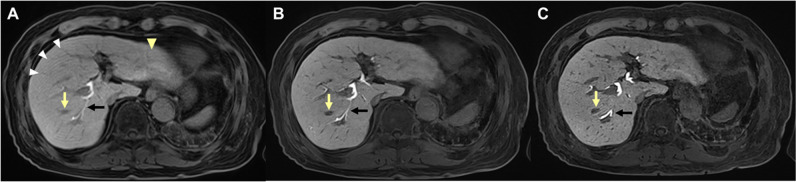 Fig. 4