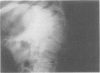 106