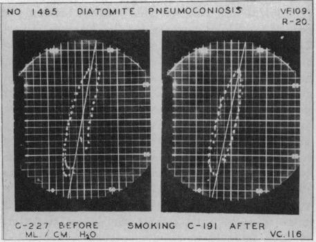 Chart 5 (e).