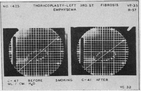 Chart 5 (c).