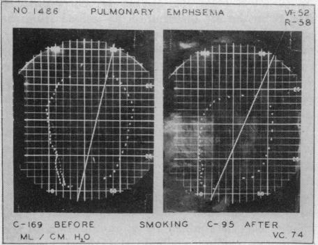 Chart 5 (b).