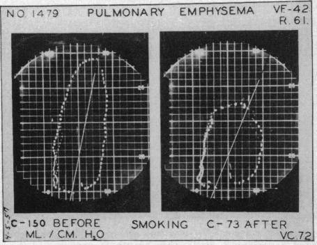 Chart 5 (a).