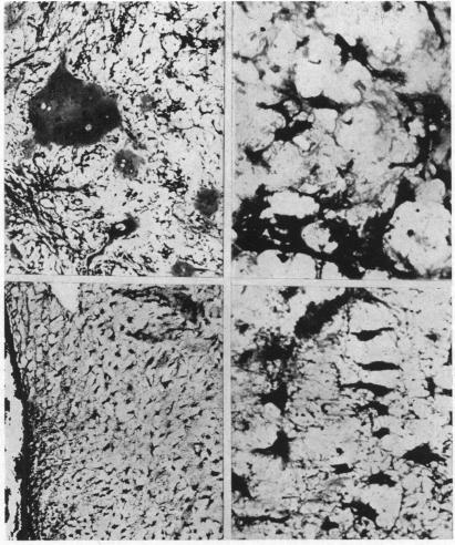 FIG. 5, 6.