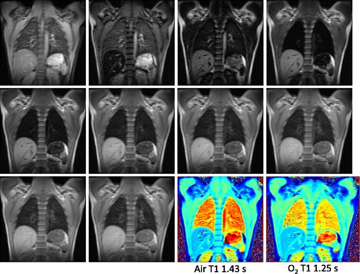 Fig. 10