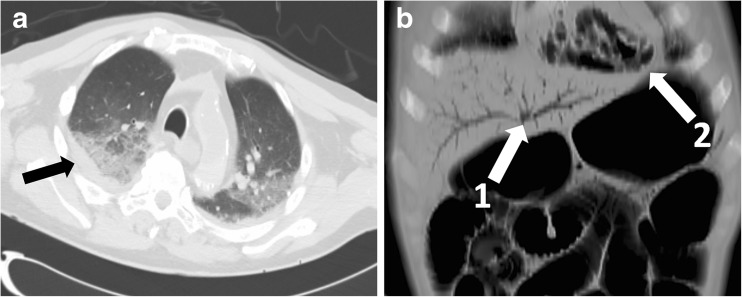 Fig. 9