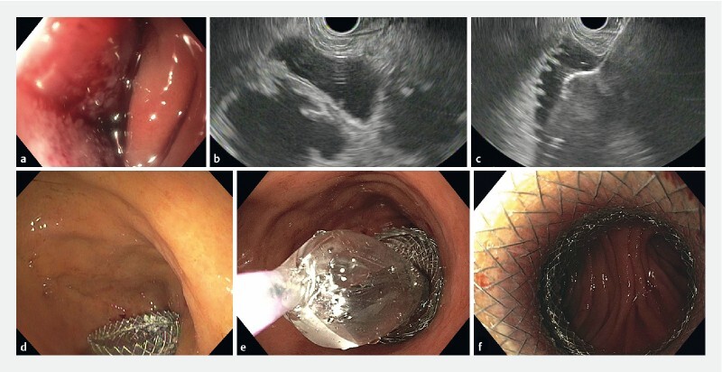 Fig. 1 a