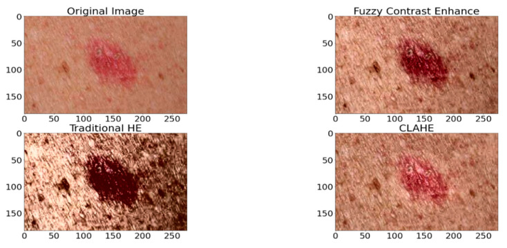 Figure 2