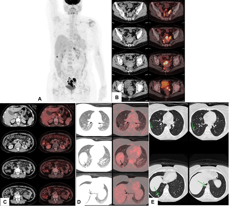 Fig. 2