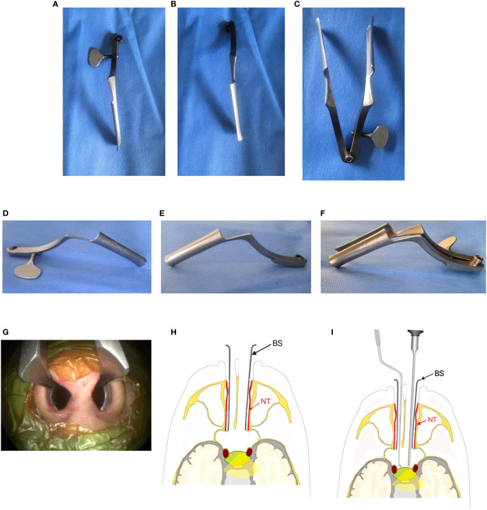 Application Of Binasal Speculum In Endoscopic Endonasal Surgery For 