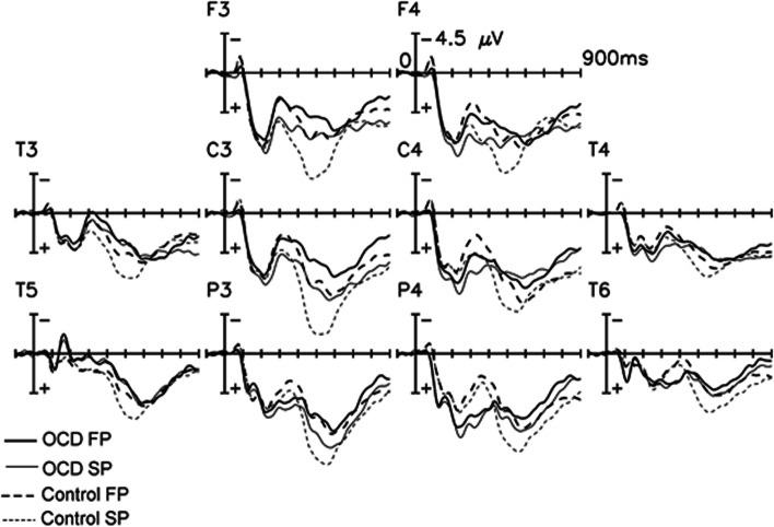 Fig. 1﻿