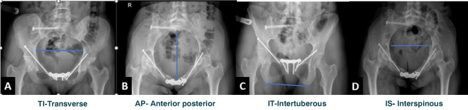 Fig. 2