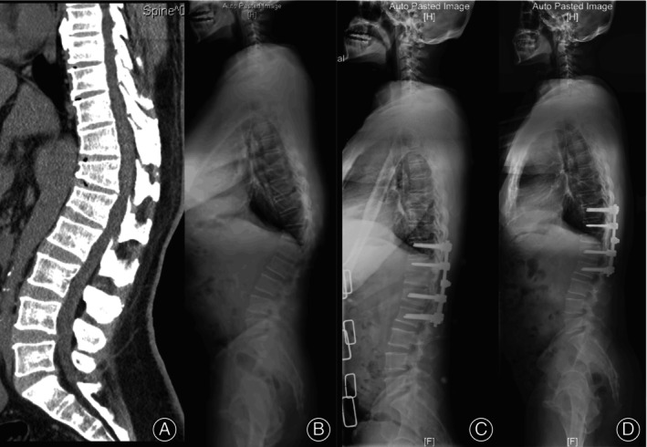 FIGURE 3