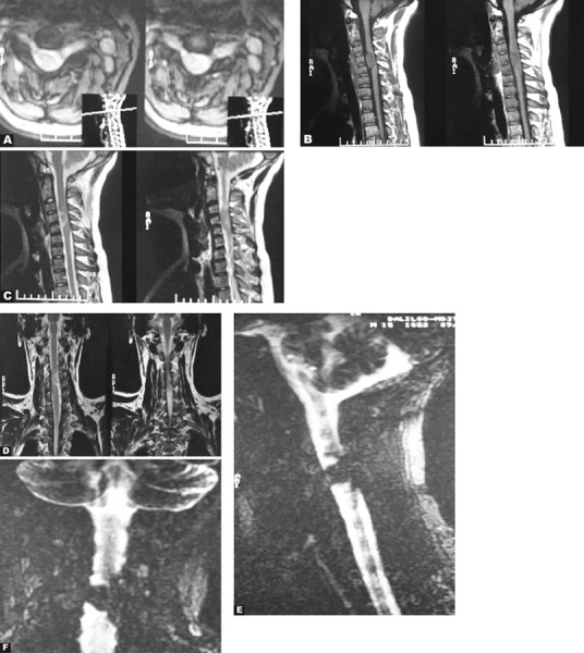 Fig. 5