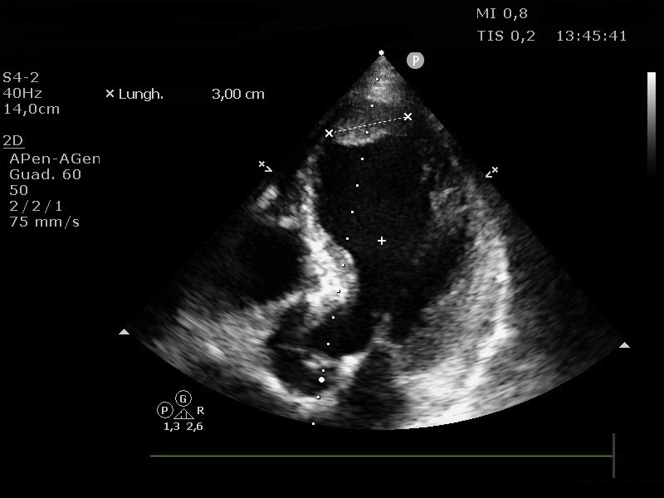 Figure 3