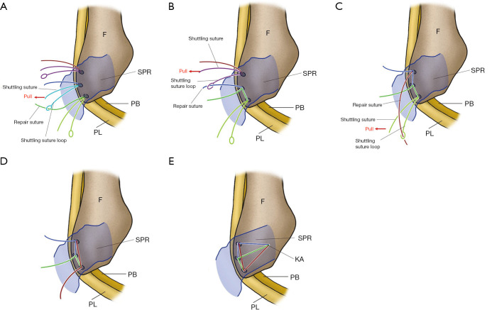 Figure 10