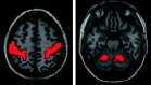 Fig 1.