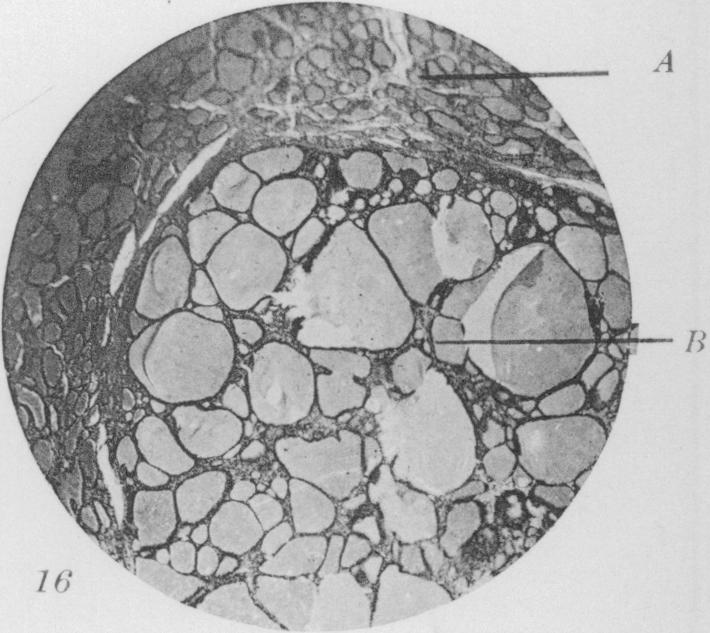 Fig. 16