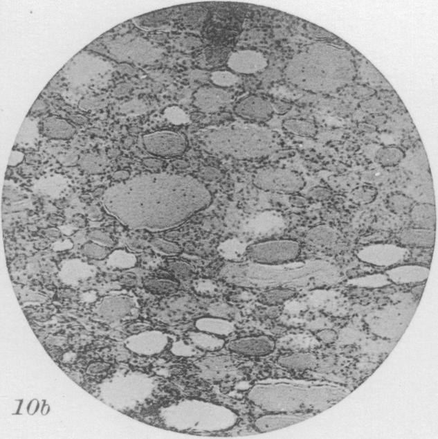 Fig. 10b