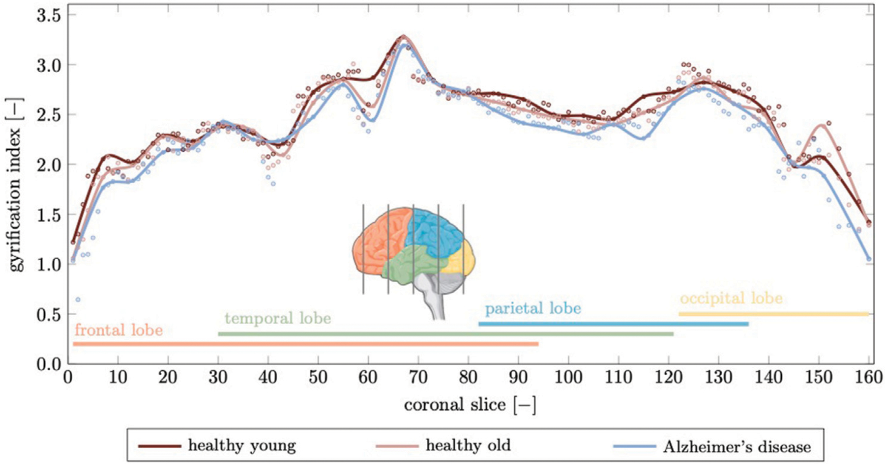 FIGURE 11 |