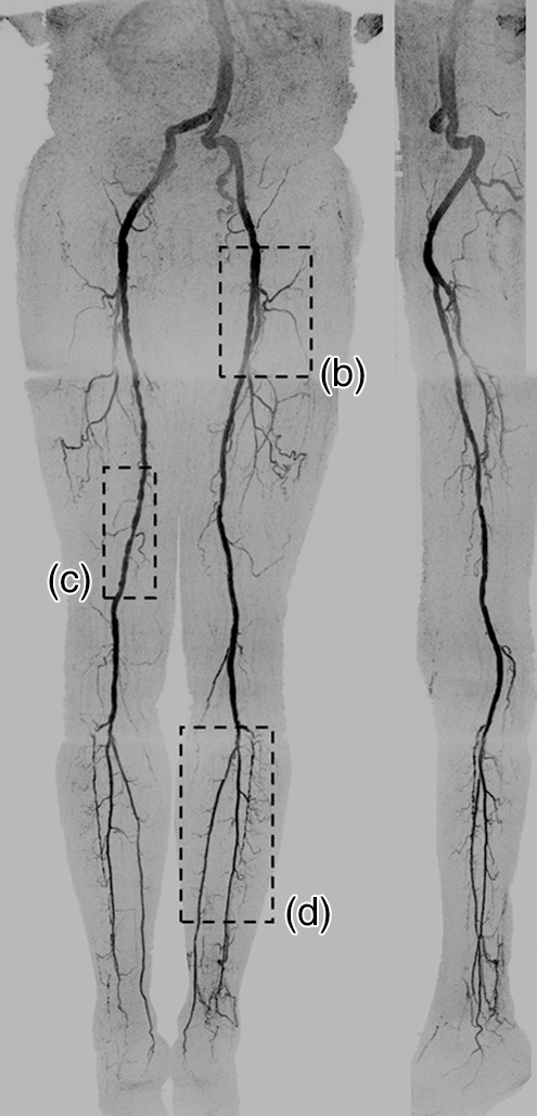 Figure 3a: