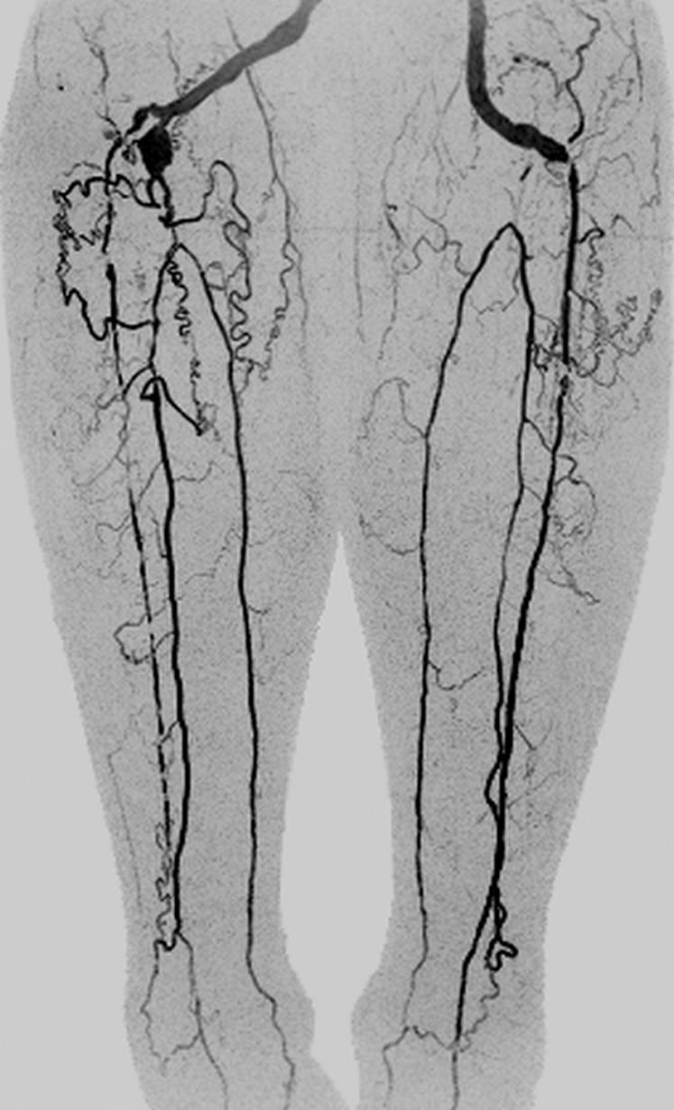 Figure 4b: