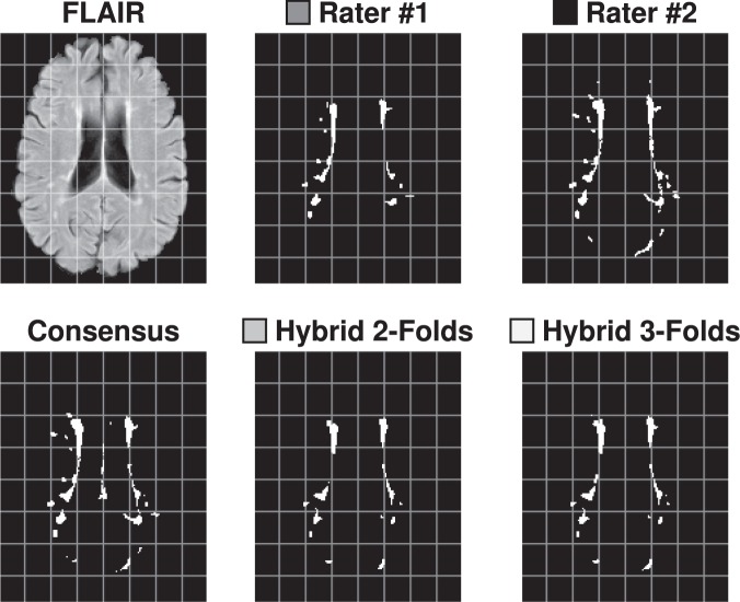 Figure 13