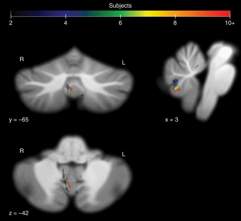 Fig. 4