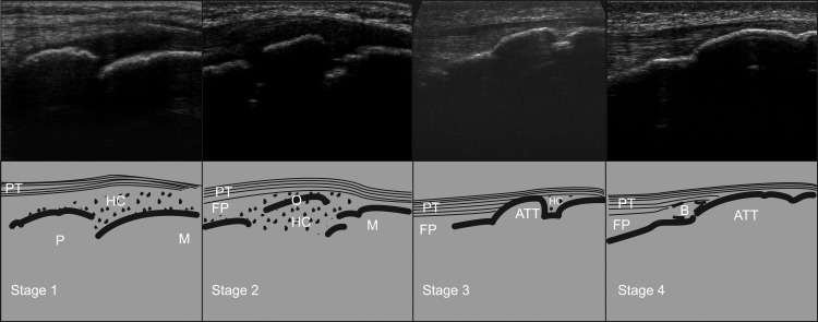 Figure 1