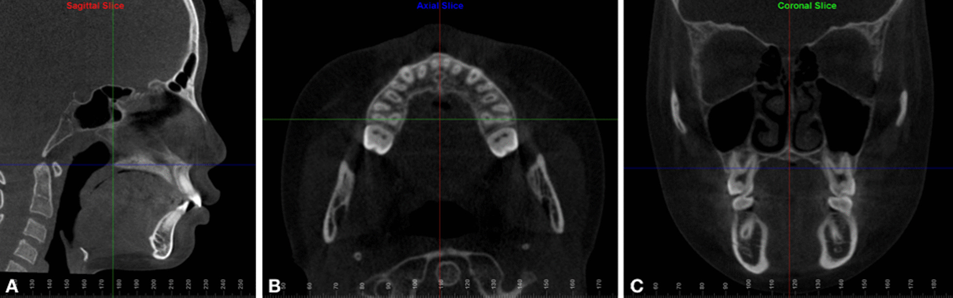 Fig. 5