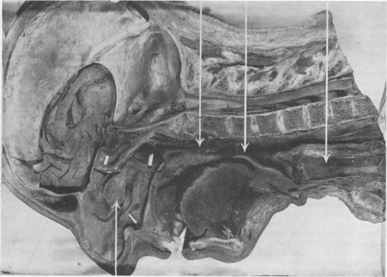 graphic file with name brjindmed00252-0037-b.jpg