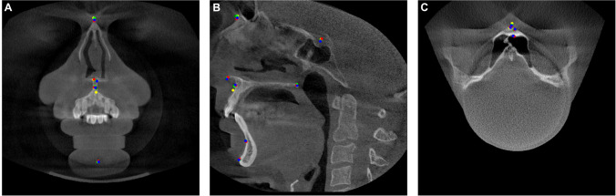 Fig. 1