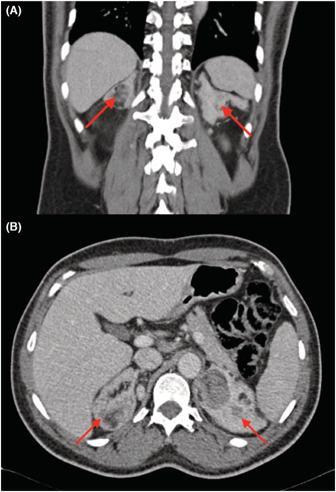 FIGURE 1