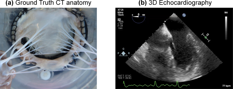 Figure 1: