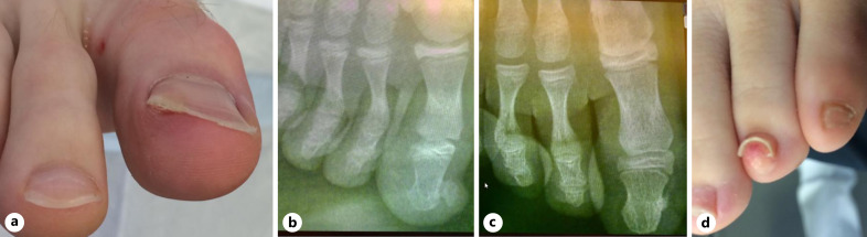 Fig. 20.