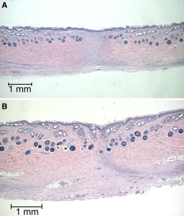 Fig. 10