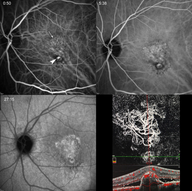 Fig. 6