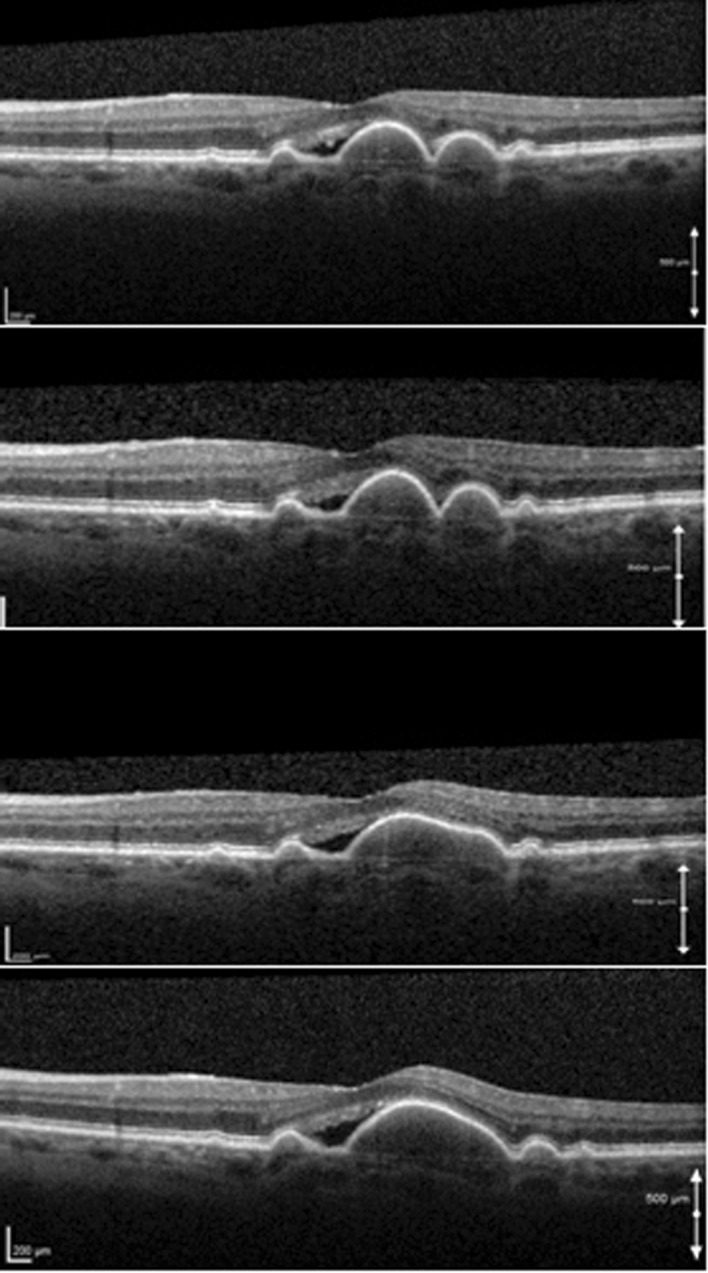 Fig. 4