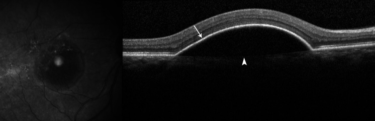 Fig. 2